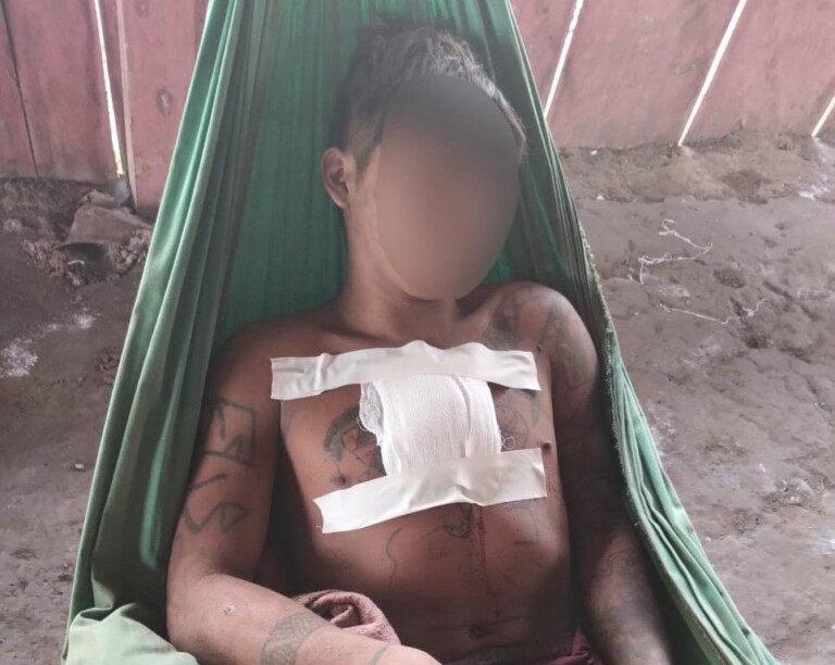 Irmão ferido foi encaminhado à Boa Vista para atendimento médico. Foto: Reprodução/Redes Sociais
