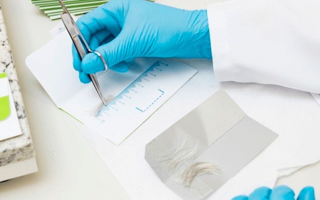 O exame toxicológico é realizado a partir de amostras de cabelo, pelo ou unha, para a verificação do consumo de substâncias psicoativas (Foto: Divulgação)
