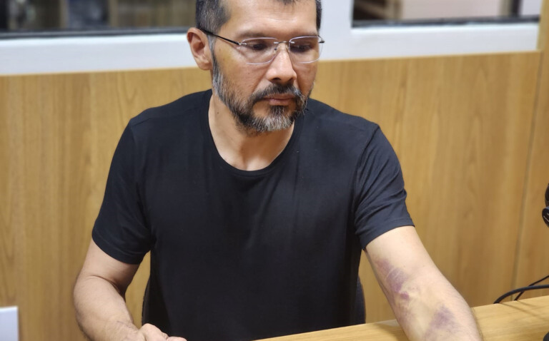 Ídio ainda se recupera das agressões que sofreu enquanto esteve nas mãos dos sequestradores 