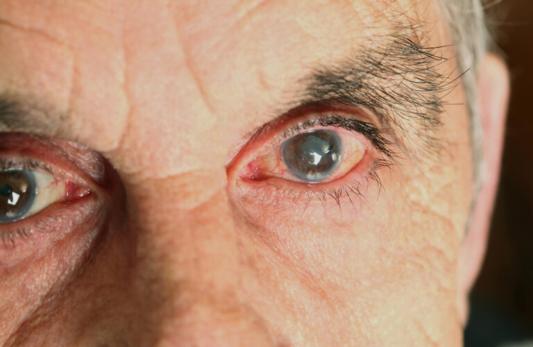 Anvisa também alerta sobre suplementos que prometem emagrecimento e ganho de massa muscular. Foto: Reprodução/GettyImages