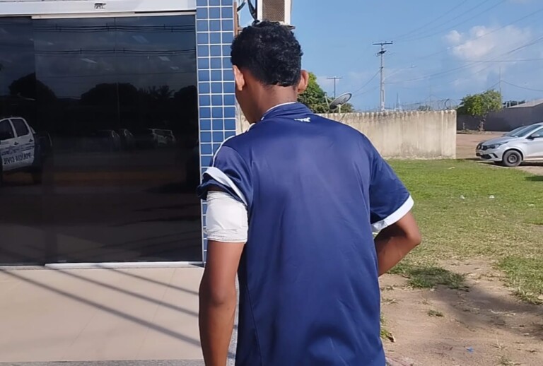 Após receber atendimento médico, a vítima foi apresentada na Central de Flagrantes para prestar depoimento (Foto: Divulgação) 