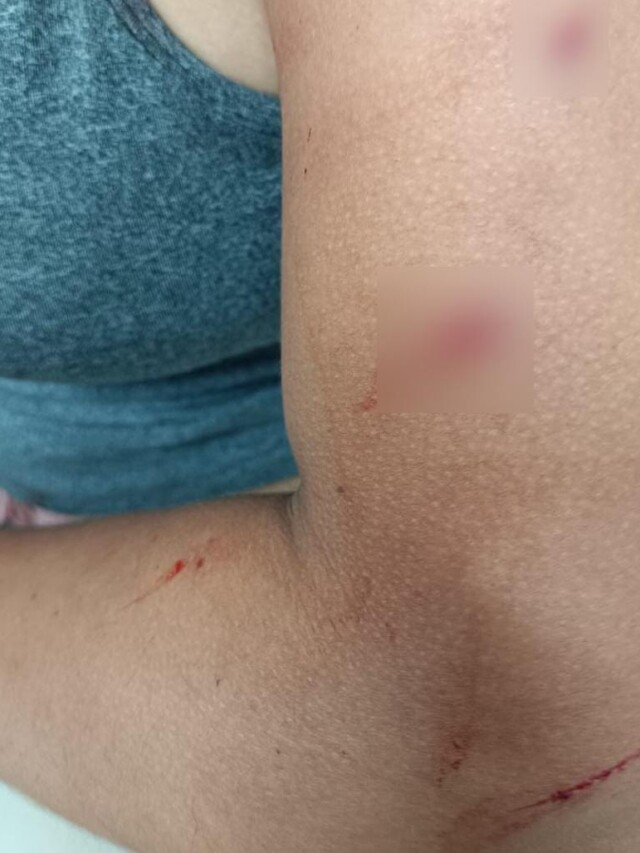 A mulher foi esfaqueada no pescoço, lábio e braço (Foto: Divulgação) 