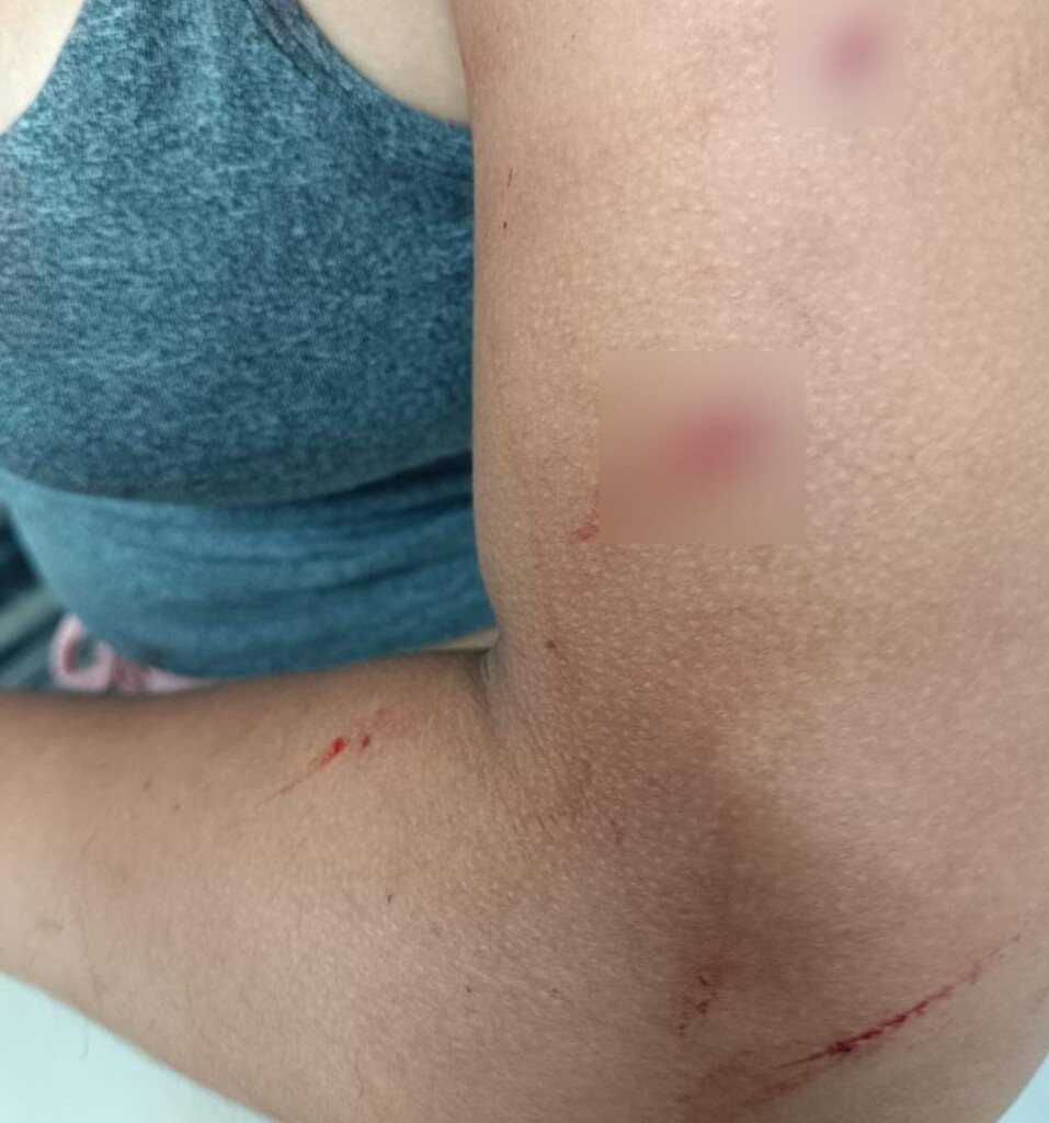 A mulher foi esfaqueada no pescoço, lábio e braço (Foto: Divulgação) A mulher foi esfaqueada no pescoço, lábio e braço (Foto: Divulgação)