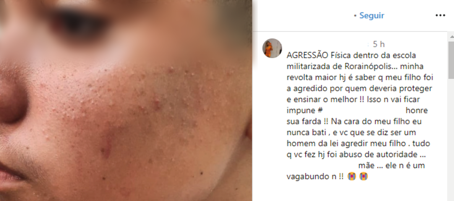 Mãe denuncia que estudante apanhou e foi ameaçado dentro de Colégio Militarizado