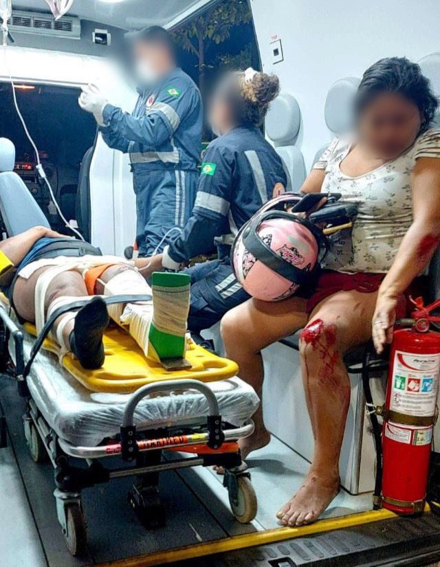 A motociclista sofreu possível fratura na perna esquerda (Foto: Divulgação)
