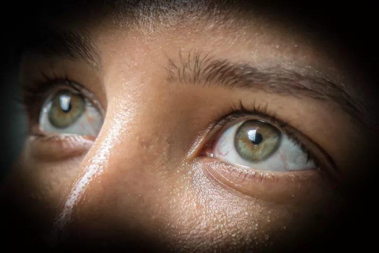 Doença oftalmológica é genética, mas pode ser causada por fatores secundários (Foto: Eduardo Andrade/ SupCom-ALE-RR)
