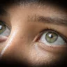 Doença oftalmológica é genética, mas pode ser causada por fatores secundários (Foto: Eduardo Andrade/ SupCom-ALE-RR)