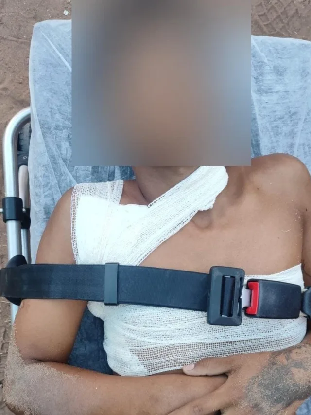 O adolescente foi socorrido pelo Serviço de Atendimento Móvel de Urgência (SAMU) e levado ao Hospital Geral de Roraima (HGR), onde passa por atendimento médico. (Foto: Divulgação)