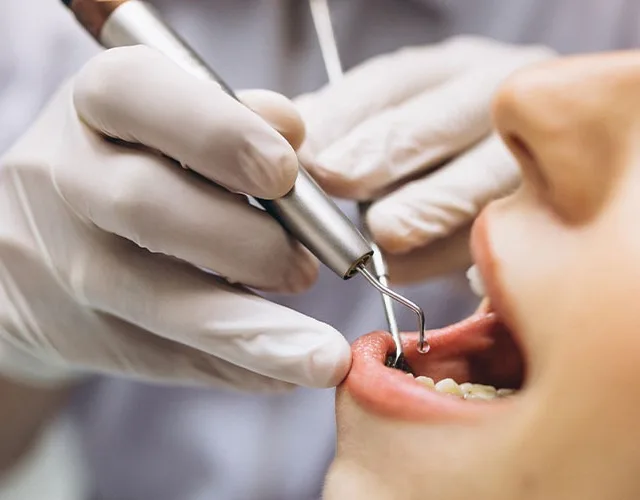 Embora ainda faltem estudos conclusivos, os dentistas já observam uma série de impactos adversos que merecem atenção (Foto: Divulgação)