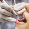 Embora ainda faltem estudos conclusivos, os dentistas já observam uma série de impactos adversos que merecem atenção (Foto: Divulgação)