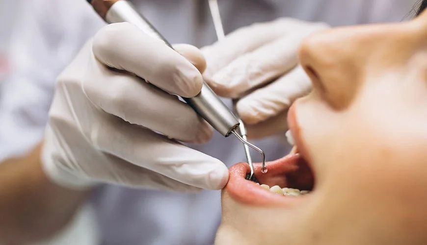 Embora ainda faltem estudos conclusivos, os dentistas já observam uma série de impactos adversos que merecem atenção (Foto: Divulgação) Embora ainda faltem estudos conclusivos, os dentistas já observam uma série de impactos adversos que merecem atenção (Foto: Divulgação)