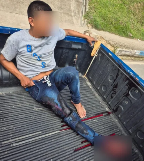 Homem é esfaqueado na coxa pelo enteado após invadir casa da ex-mulher