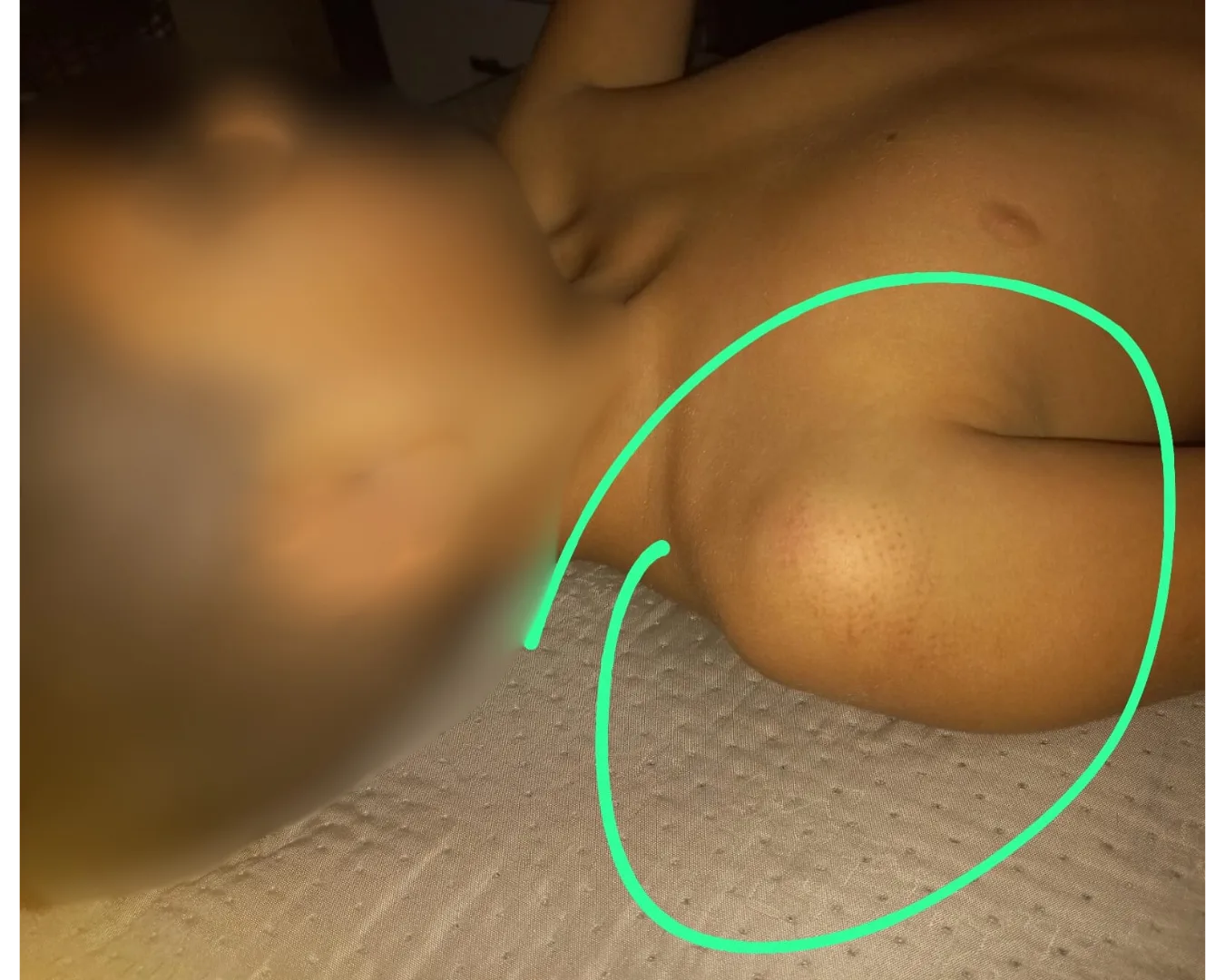 Mãe diz que percebeu hematomas na criança após chegar em casa (Foto: Arquivo Pessoal)