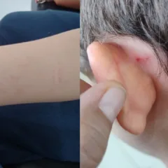 Avó diz que neto autista foi agredido em escola particular