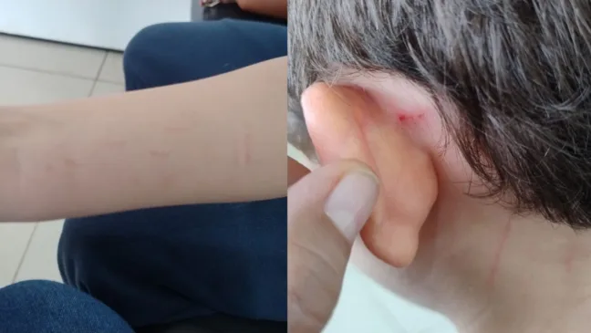 Avó diz que neto autista foi agredido em escola particular