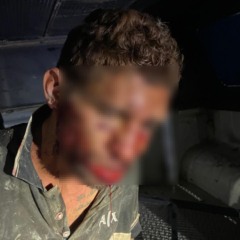 Por conta dos ferimentos, o suspeito foi levado ao hospital e depois à delegacia (Foto: Divulgação) 