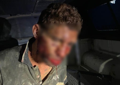 Por conta dos ferimentos, o suspeito foi levado ao hospital e depois à delegacia (Foto: Divulgação) 