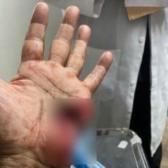 O policial feriu a mão esquerda (Foto: Divulgação) 