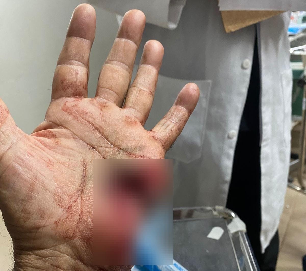O policial feriu a mão esquerda (Foto: Divulgação) 