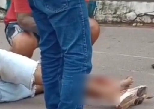 A vítima teve a fratura exposta no pé esquerdo (Foto: Divulgação) 