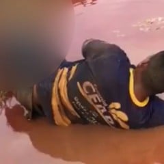 Vídeo de homem com perna amputada em acidente de moto não foi gravado em Roraima