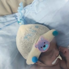 Dia da Touca Maluca no Hospital Materno Infantil Nossa Senhora de Nazareth. (Foto: Divulgação)