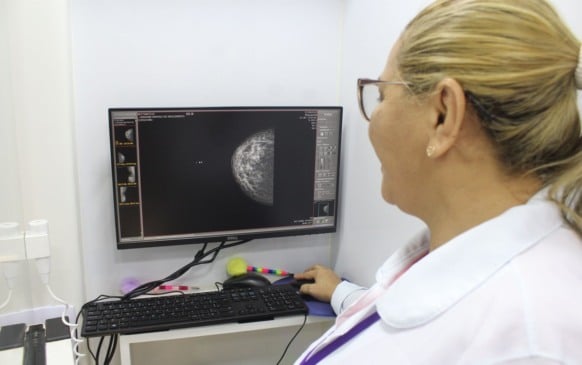 Os documentos necessários para atendimento são RG, cartão do SUS e comprovante de residência. (Foto: ASCOM/SESAU)