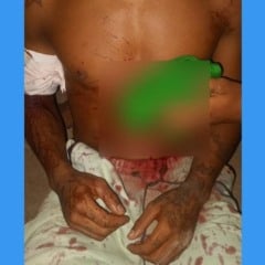 A vítima foi encaminhada ao HGR (Foto: Divulgação) 