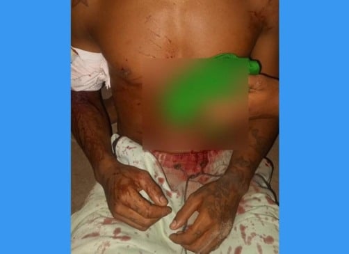 A vítima foi encaminhada ao HGR (Foto: Divulgação) 