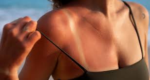 Assembleia aprova projeto para regulamentar o uso de câmaras de Bronzeamento Artificial Assembleia aprova projeto para regulamentar o uso de câmaras de Bronzeamento Artificial