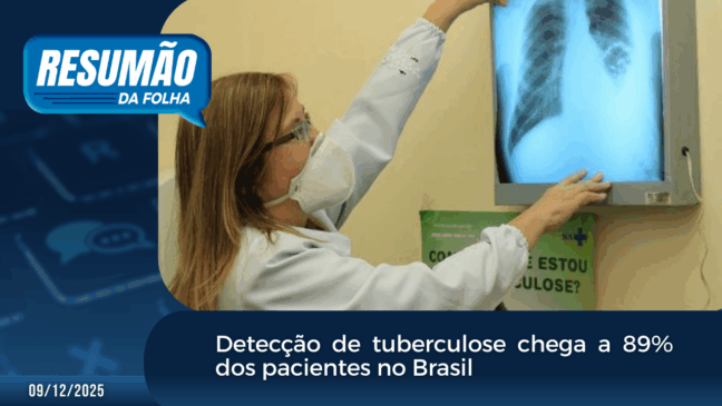 Detecção de tuberculose chega a 89% dos pacientes no Brasil