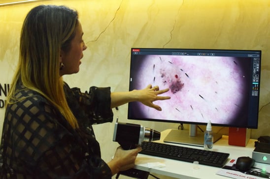 Unacon atendeu 102 casos de Câncer de Pele em 2025; Especialista alerta para prevenção