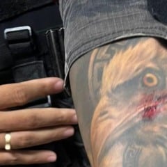 Braço do sargento atingido pelo facão (Foto: Divulgação)