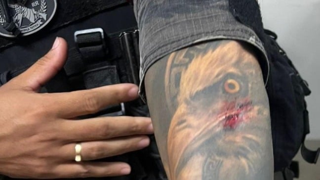 Braço do sargento atingido pelo facão (Foto: Divulgação)