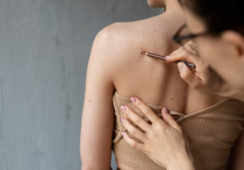 Especialista destaca diagnóstico precoce no combate ao câncer mais comum no Brasil