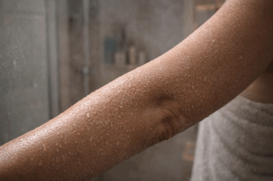 O erro comum no banho quente que resseca a pele sem você perceber