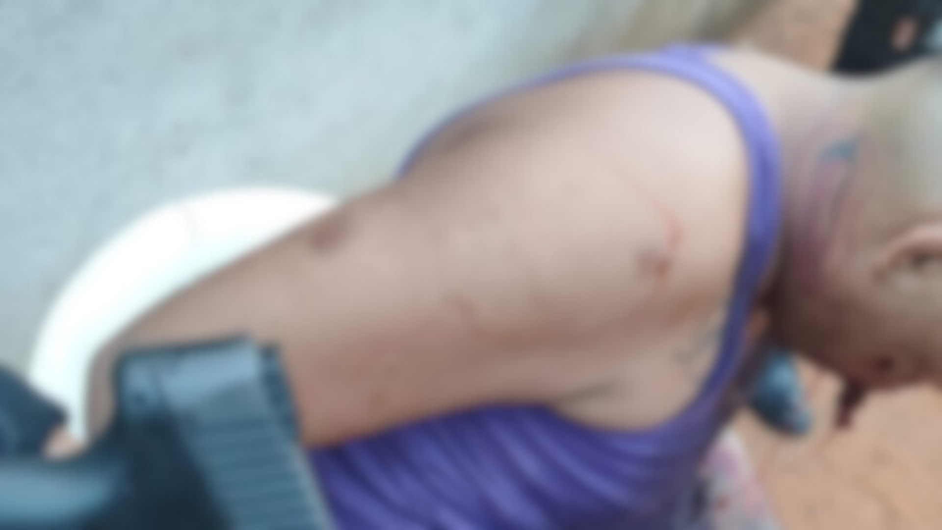 Homem é baleado no rosto e polícia encontra drogas em casa de suspeito