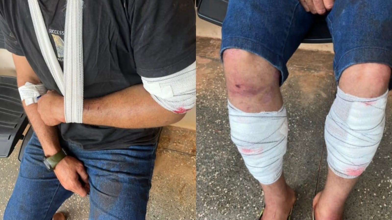 Foragido de RO e homem com medidas cautelares são presos por espancar garimpeiro em Roraima