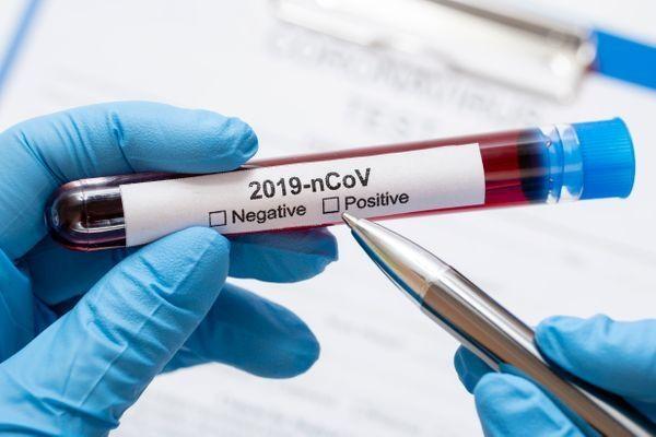 A partir de agora, a mudança já é constatada no Boletim Epidemiológico (Foto: Divulgação)