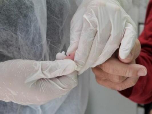 Até o momento, 190 pessoas já foram testadas na Capital (Foto: Divulgação)