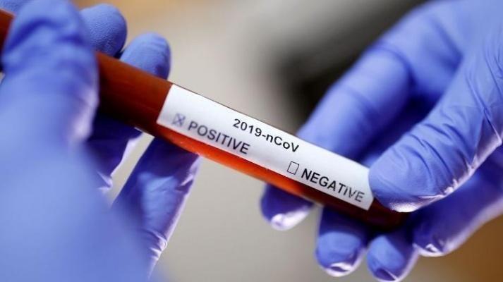 Mais 87 novos casos de Covid-19 são registrados (Foto: Divulgação))