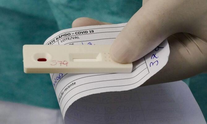 Lacen analisou 148 amostras de pacientes (Foto: Agência Brasil)