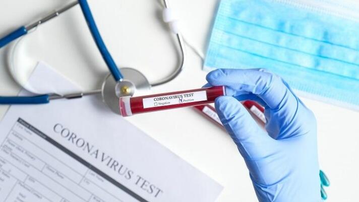 32 amostras foram positivas e um teste rápido também teve confirmação neste sábado - Foto: Divulgação