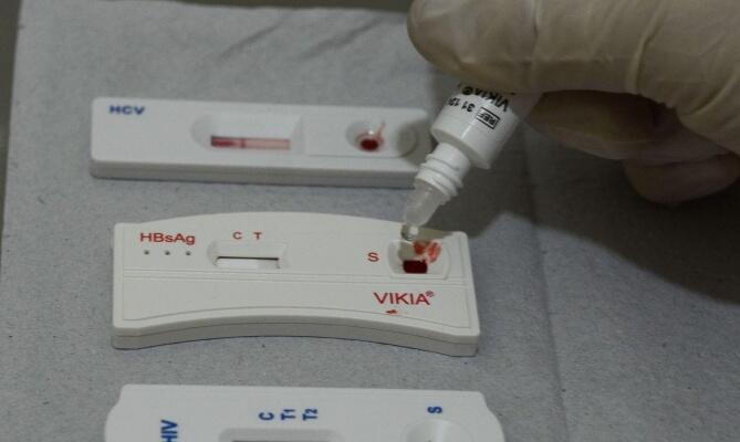 Seis testes rápidos foram realizados no domingo (Foto: Agência Brasil)