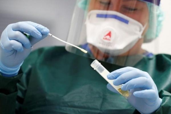 Testes para identificação do covid (Foto: Agência Brasil)