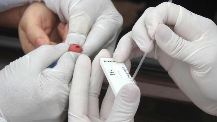 O Lacen analisou hoje 87 amostras de casos suspeitos. Destas, 70 foram confirmadas. Além disso,13 testes rápidos tiveram resultado positivo - Foto: Divulgação