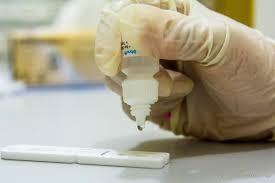 O município informou que adquiriu 4.500 testes (Foto: Divulgação)