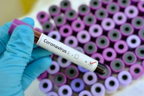 Segundo a Sesau, foram realizadas 168 verificações entre amostras coletadas pelo Lacen e testes rápidos - Foto: Divulgação