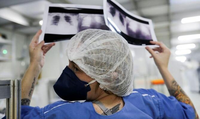 Até o momento, pesquisa avaliou 1.144 imagens de pneumonias (Foto: Divulgação)