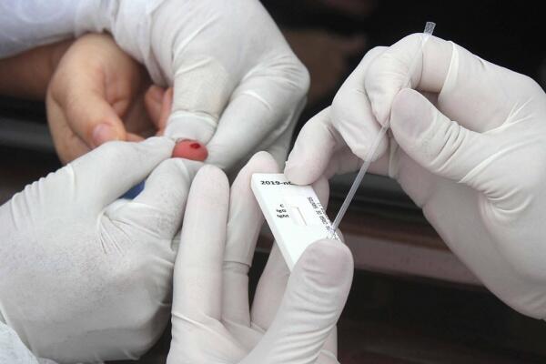 Os 402 resultados positivos foram obtidos por meio dos testes rápidos (Foto: Agência Brasil)